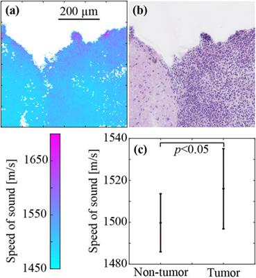 Alteration of speed-of-sound by fixatives and tissue processing methods in scanning acoustic microscopy